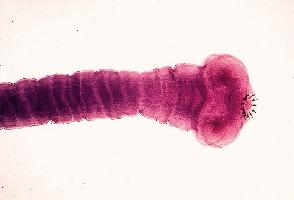 Foto: Pork tapeworm